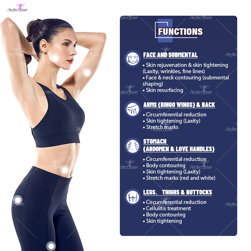 Perfectlaser 4'ü 1 Arada Vela  - Vacuum Cavitation Body Contouring incelemesi ve fiyatı