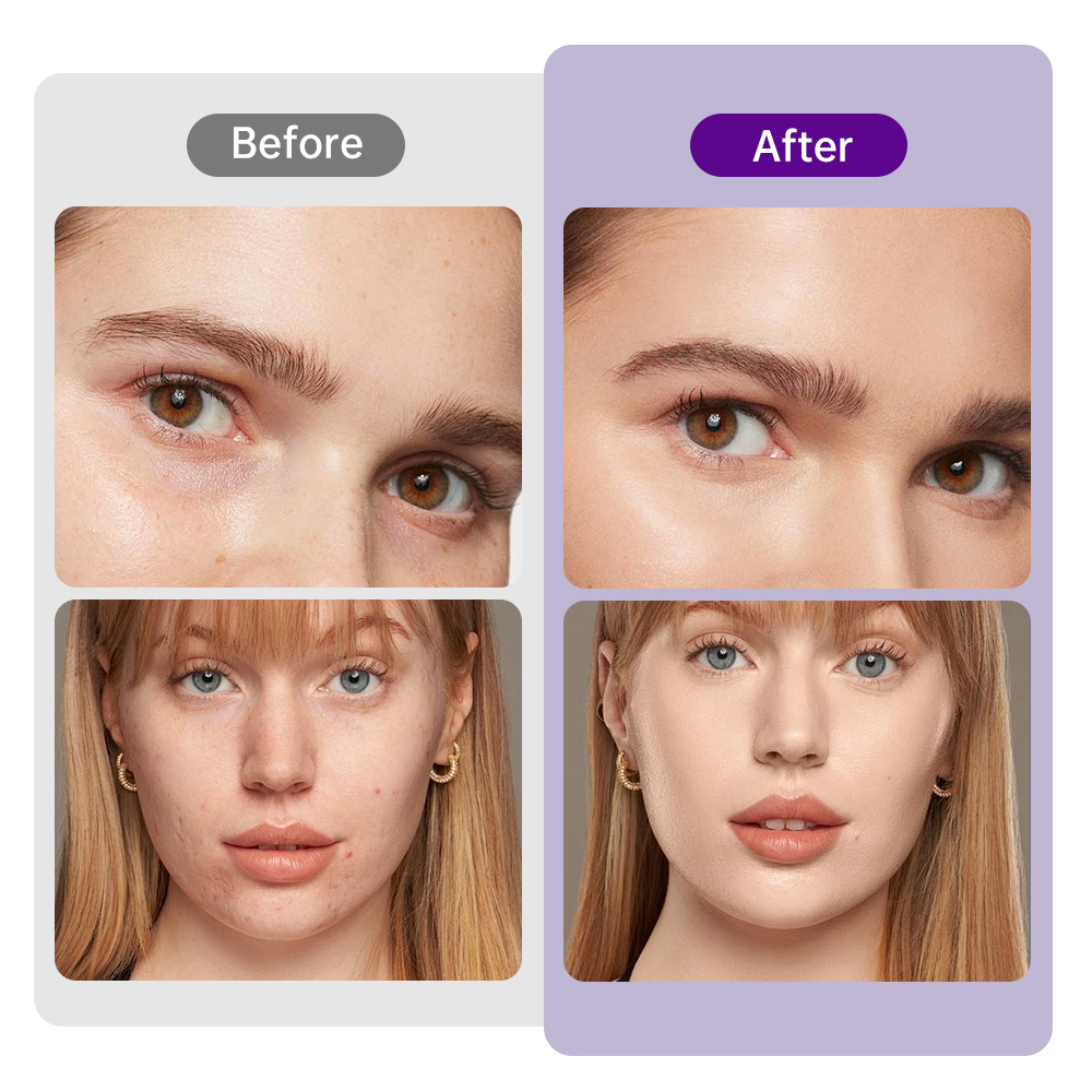 Vakumlu Radyofrekanslı Vücut Ş - Vacuum Cavitation Body Contouring incelemesi ve fiyatı